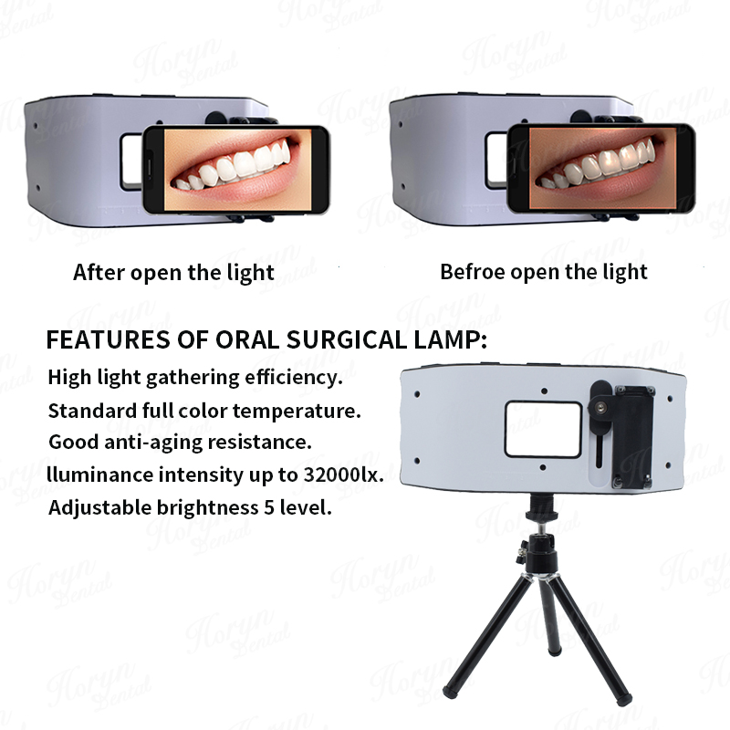 Dental Flash Light Photography - огляд і ціна Photography Dental